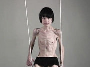 anorexic Stasha 9