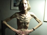 anorexic Sonja 8